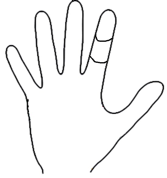 Upper phalanges of fingers longer than bottommost